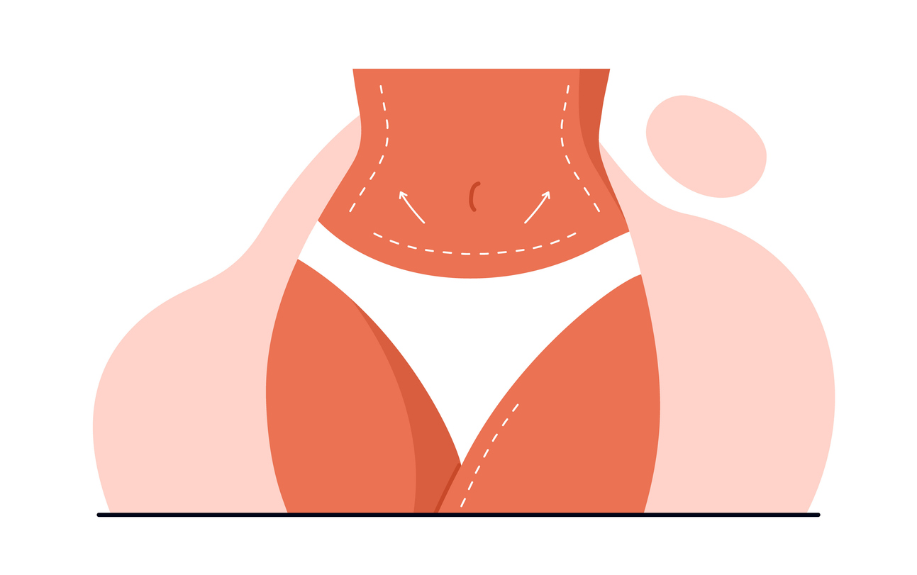 Featured image for what to expect from a tummy tuck procedure